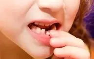 به این دلایل مراقب دندان‌های شیری فرزندانتان باشید!