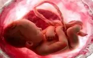 تصویری متفاوت از یک جنین که دنیا را متحیر کرد!