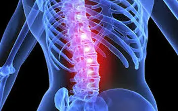 آیا عمل دیسک کمر خطرناک است؟