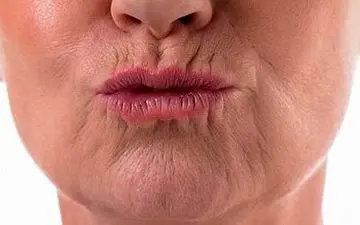 چگونه چین و چروک دور لب را از بین ببریم؟ رازهای زیبایی برای داشتن چهره‌ای جوان‌تر