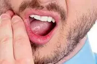 این نوع دندان درد یک علت مهم دارد!