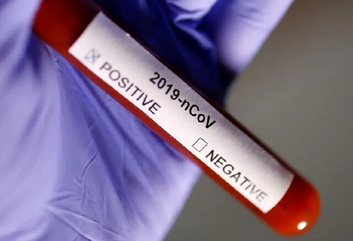 چهارشنبه 11 آبان/ تازه ترین آمارها از همه گیری ویروس کرونا در جهان