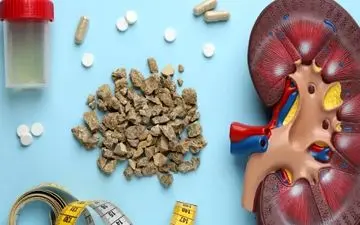 دلیل ایجاد سنگ کلیه چیست؟