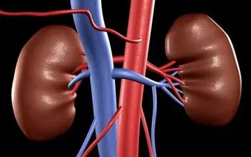 بیماری مزمن کلیوی عامل مرگ سالانه بیش از یک میلیون نفر در جهان