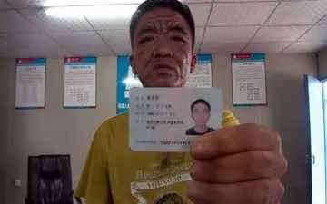 بیماری مرموزی که درمان ندارد/ مرد 30 ساله ای که ناگهان پیرمرد شد