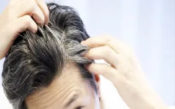 سفید شدن مو نشانه خطر ابتلا به بیماری قلبی