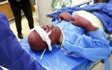  ۳۸ نفر نفر بر اثر سوختگی در کرمانشاه جانباختند 