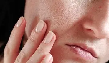 این میوه پوست شما را جوان نگه می‌دارد