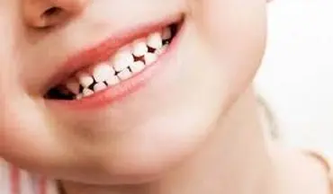 نکاتی که والدین در مورد دندان شیری کودکان باید بدانند