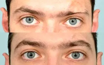 مزایا و مراقبت‌های کاشت ابرو در آقایان!