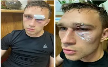 "اقدام به قتل"؛ اتهام برای حمله بی‌رحمانه به داور