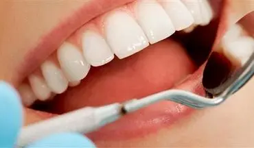 ۶ ترفند ارزان که دندان‌هایتان را مثل مروارید سفید می‌کند