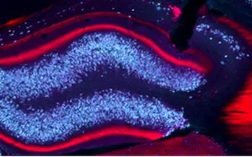 
مقابله با صرع به کمک نور
