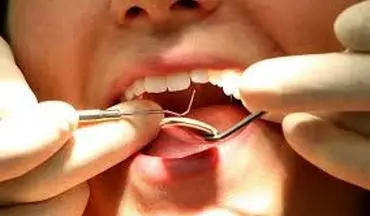 اثرات مستقیم استرس روی دهان و دندان