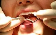 اثرات مستقیم استرس روی دهان و دندان