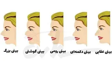  تست شخصیت شناسی از روی فرم بینی| این تست راز شما را برملا می کند