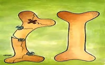 داروهای پوکی استخوان با احتیاط مصرف شود