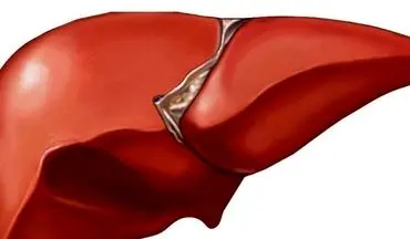 اگر کبدتان چرب است روز خود را با این نوشیدنی ها شروع کنید
