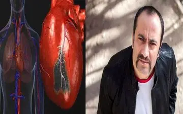  چگونه سکسکه باعث مرگ «عارف لرستانی» شد؟