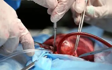 ملاقات خانواده اهدا کنندگان و دریافت کنندگان عضو + فیلم