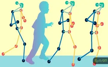 ارزیابی بیماران مبتلا به فلج مغزی از راه دور با کمک تکنیک یادگیری ماشینی
