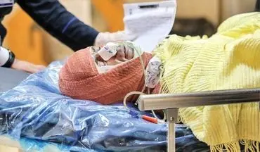  فوت ۳۳ نفر بر اثر سوختگی در کرمانشاه