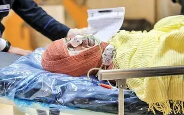  فوت ۳۳ نفر بر اثر سوختگی در کرمانشاه