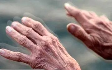 روند پیشروی پارکینسون را چطور متوقف کنیم؟