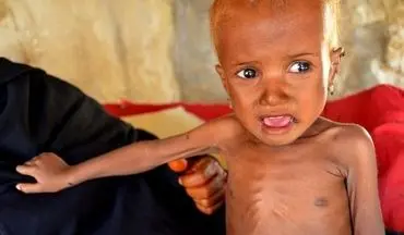 هشدار برنامه جهانی غذا در مورد گرسنگی ۱۸ میلیون یمنی