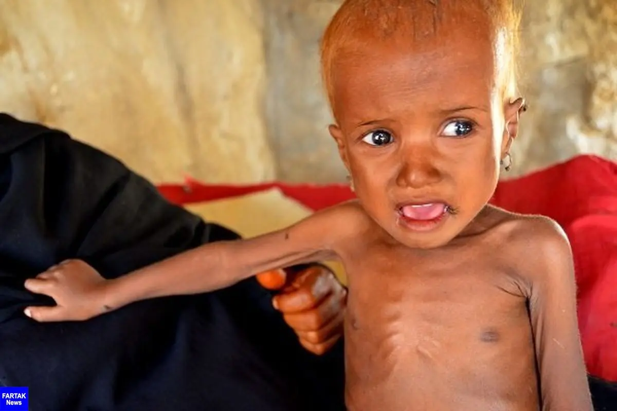 هشدار برنامه جهانی غذا در مورد گرسنگی ۱۸ میلیون یمنی