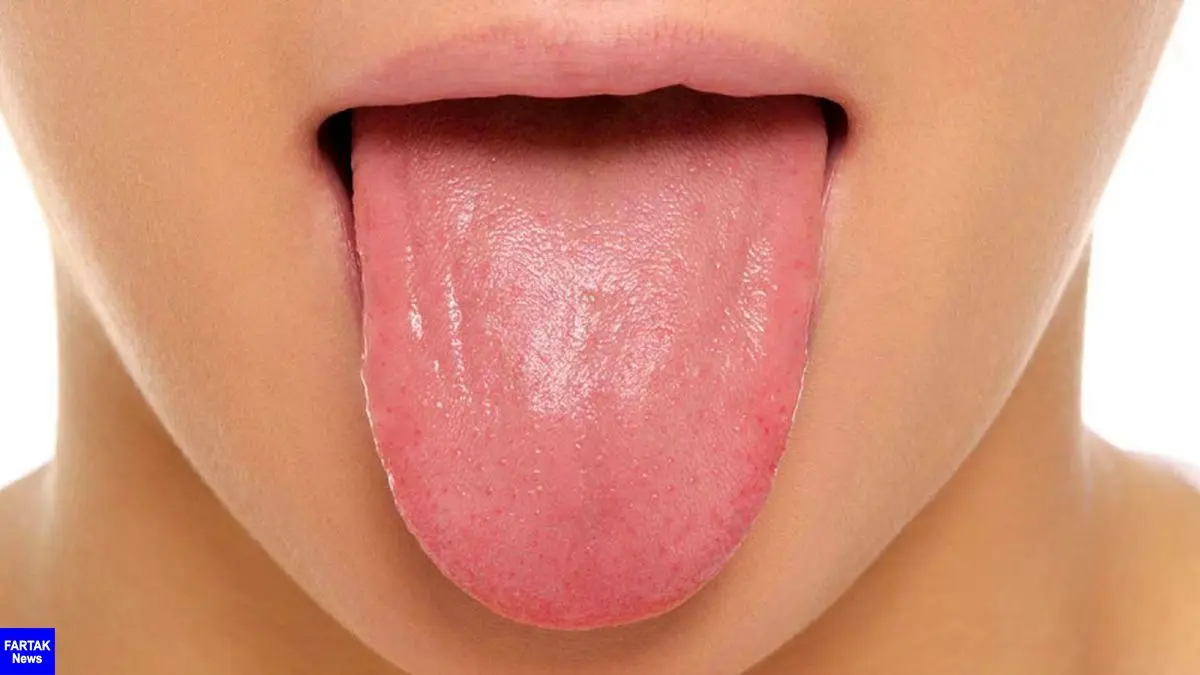 ضایعه کوچک دهانی خطرناک اند؟