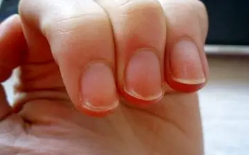 
رازهای تقویت ناخن های ضعیف و شکننده