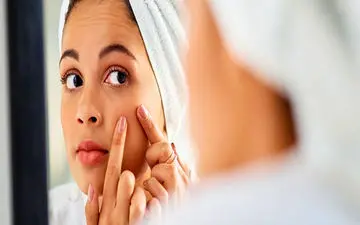 جوش هر ناحیه صورت نشانه چیست؟