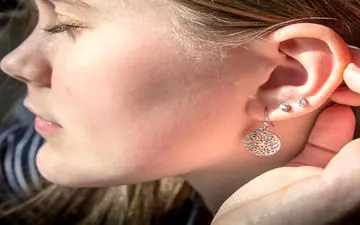  داغی گوش و علت و راه‌های درمان آن 