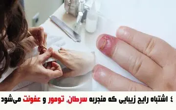 4 اشتباه رایج زیبایی که منجر به سرطان، تومور و عفونت می‌شود!