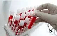 بازگشت پالایشگاه خون به دولت پس از ۱۰ سال