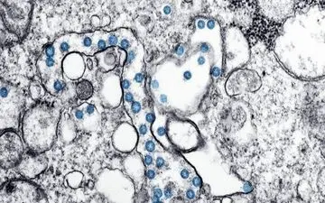 رفتار بدن ما زمانی که همزمان میزبان چند ویروس باشد، چگونه است؟