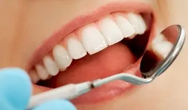 راهکارهایی باری سفیدی دندان