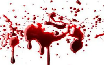 حمله آدم‌خوار فرانسوی به یک زن پس از فرار از بیمارستان روانی