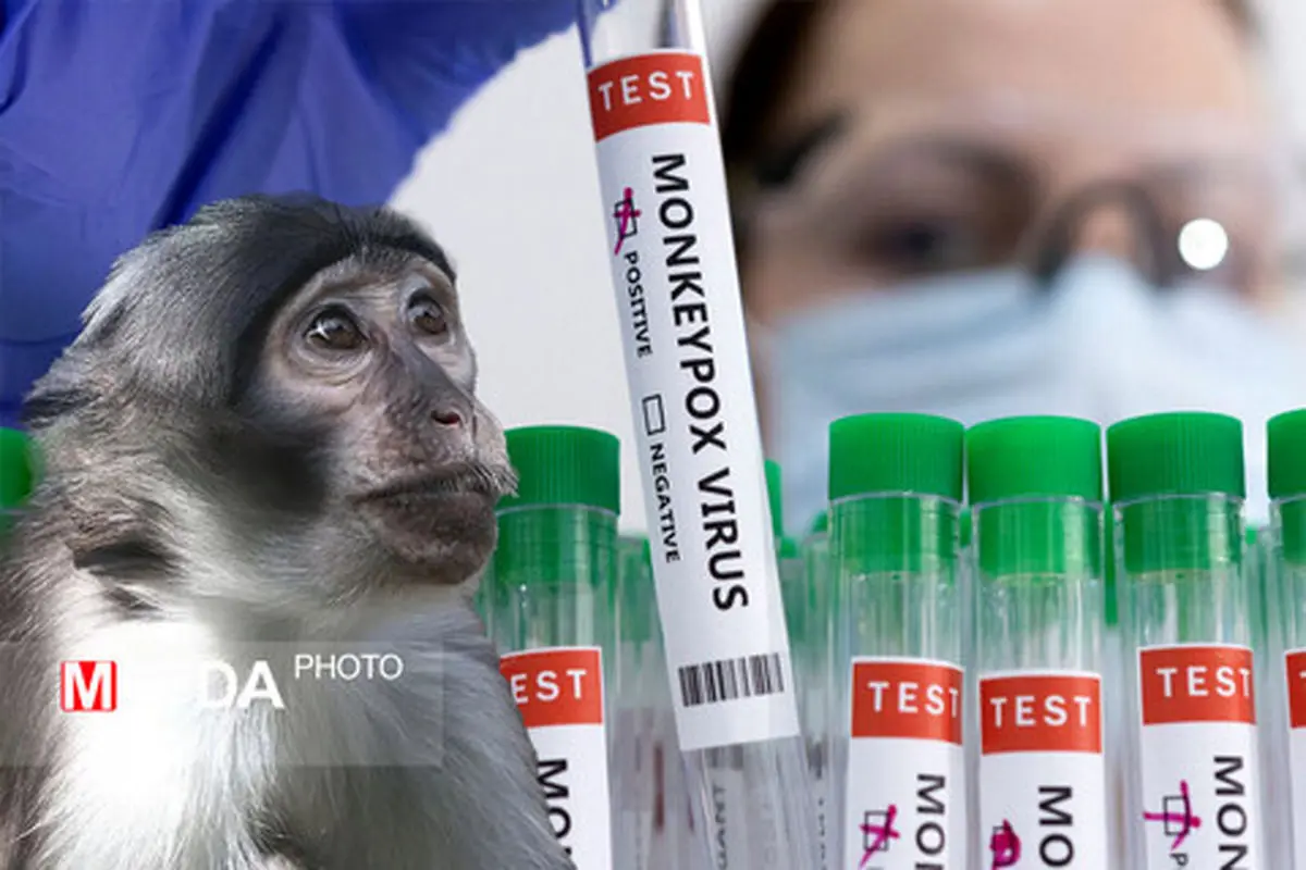 آبله میمونی سلامت جهان را تهدید می کند؟