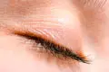 پریدن پلک چشم راست و نبض زدن چشم راست: علل و راه‌حل‌ها