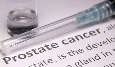 سرطان پروستات: تشخیص زودهنگام و گزینه‌های درمانی موثر