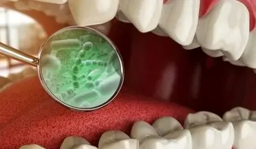 تاثیر باکتری‌های دهانی بر افزایش التهاب روده
