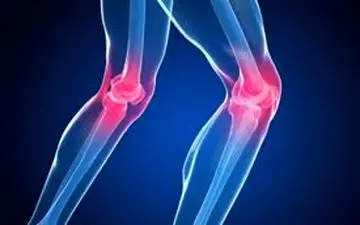 زانو درد را به سادگی در خانه درمان کنید