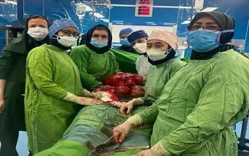 خروج کیست ۵.۵ کیلوگرمی از شکم زن باردار در سمنان