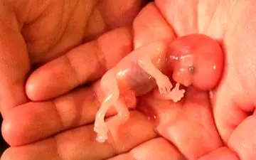 این مطلب شما را از سقط کردن باز میدارد!