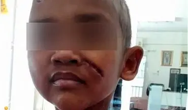 افشای شکنجه تکان دهنده سه کودک در تایلند 