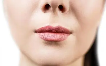  ۱۷ راه طبیعی و موثر برای درمان چین و چروک دور لب