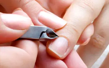 پوسته اطراف ناخن از کمبود کدام ویتامین است؟