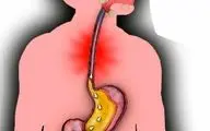 اگر رفلاکس معده دارید باید غذاهای ضد اسید را بشناسید!